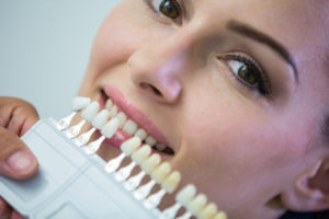 composite dental filling